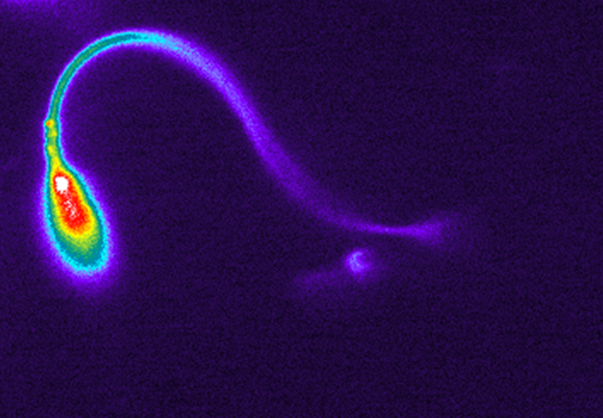 A picture of sperm taken with a microscope